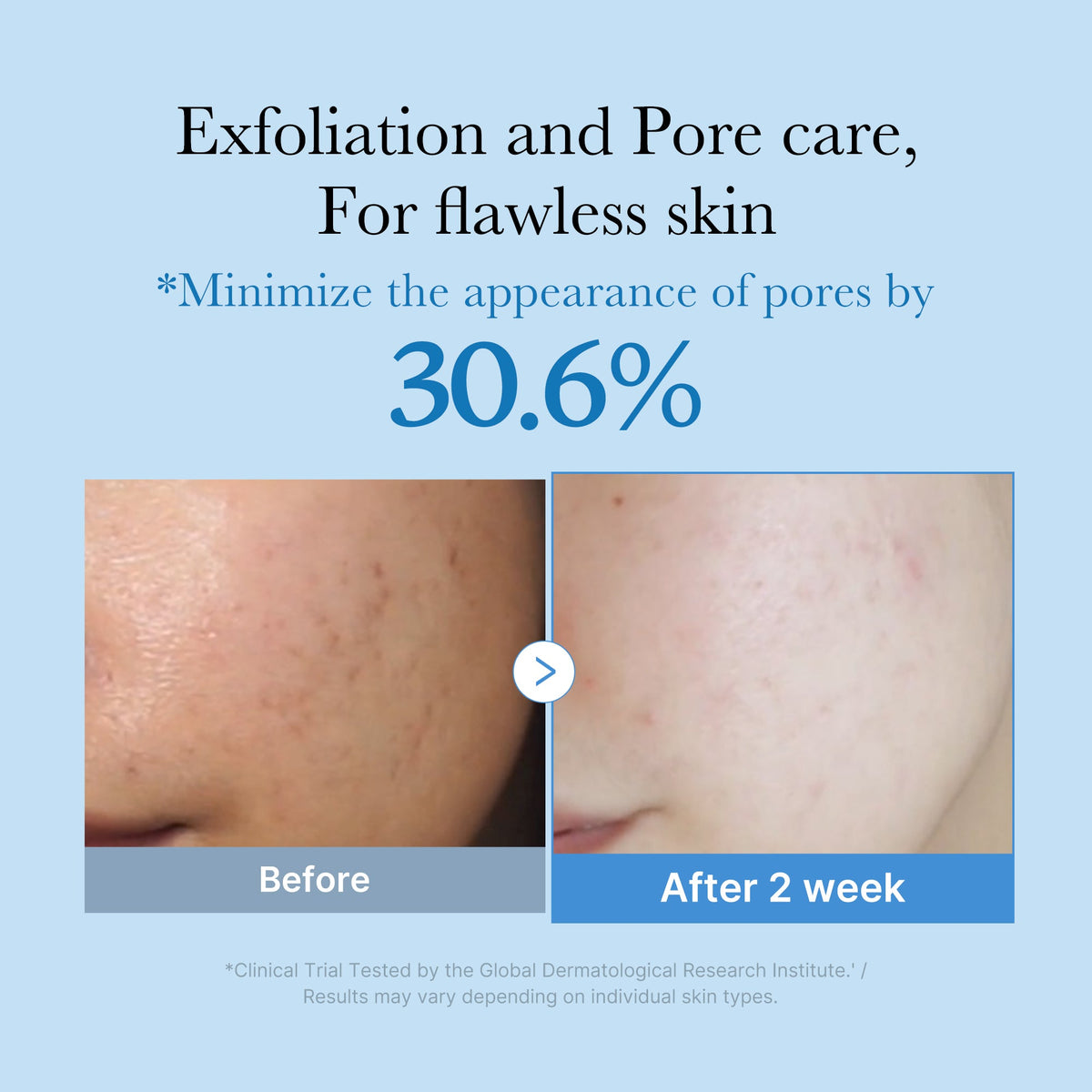 zero-pore-toner-q3 01_d6480b4e-3c08-4954-994a-ed5212c1839c.jpg