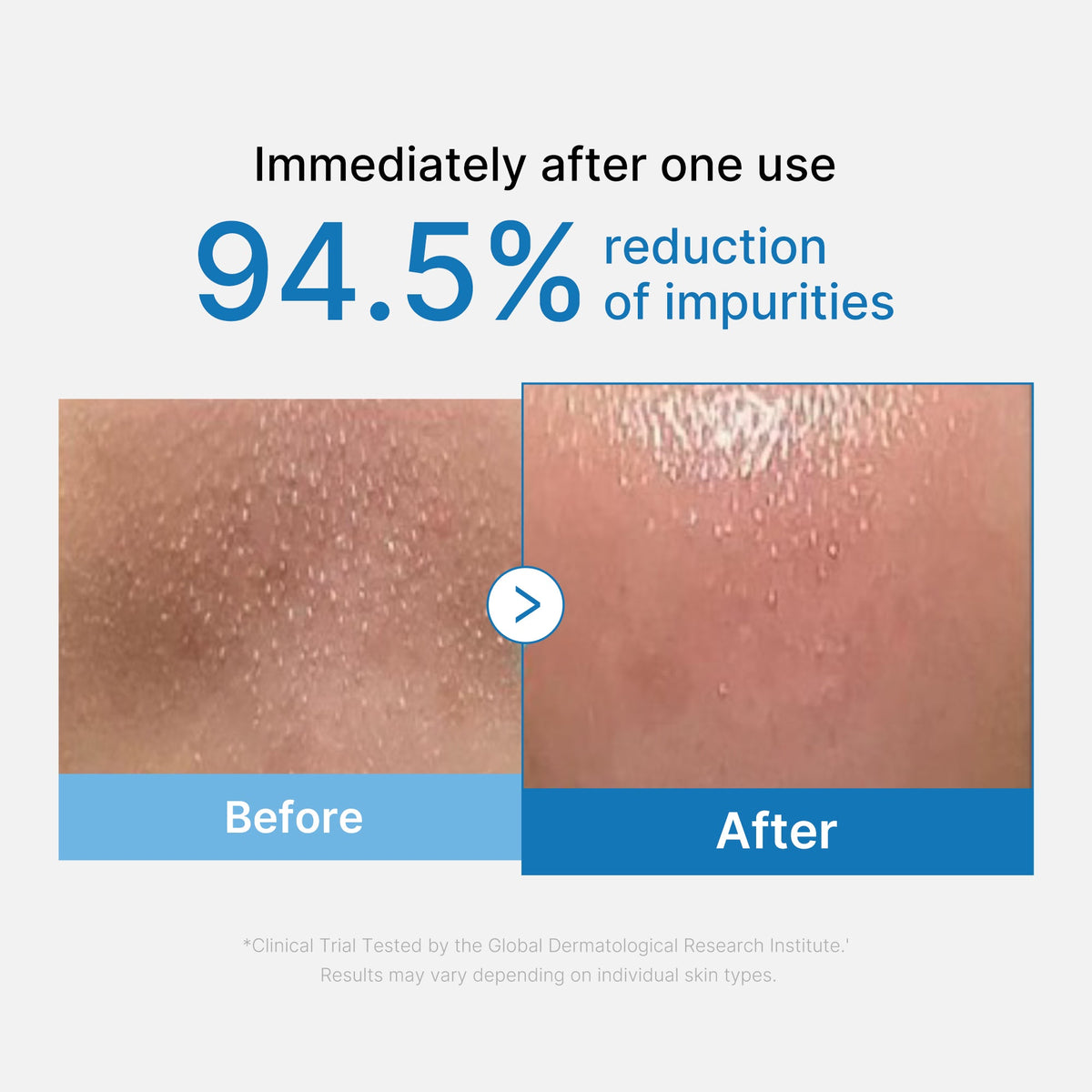 zero-pore-blackhead-deep-cleansing-oil-y0 01_eed557ec-5857-46a2-8b17-dbd67c692dcb.jpg