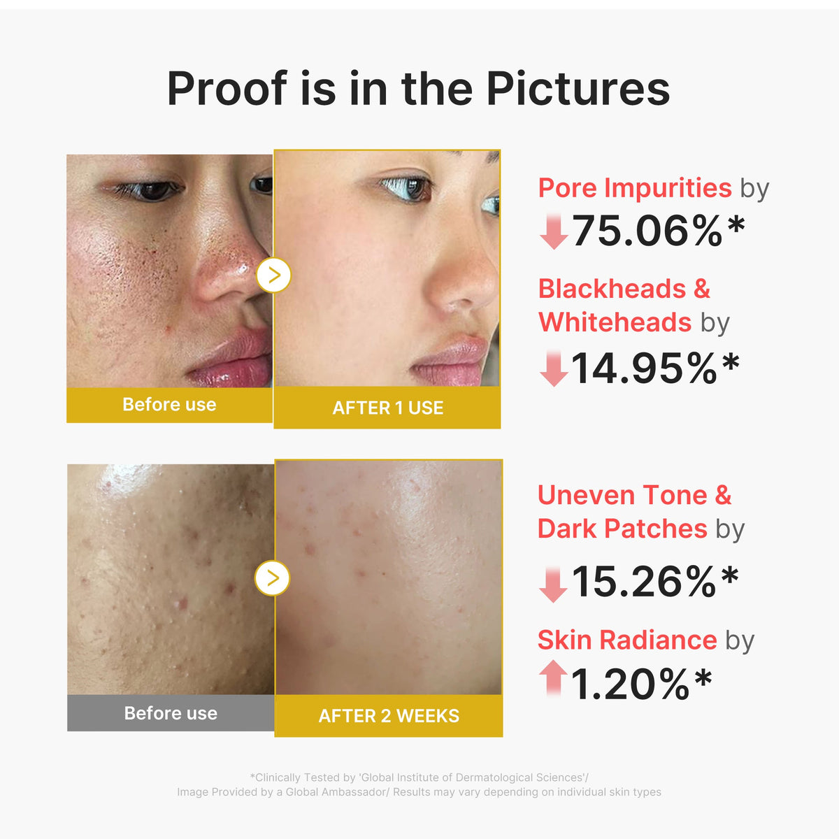 kojic-acid-turmeric-peel-shot-g7 02_45fe66d3-b3f6-4100-aa52-2afd7eded417.jpg