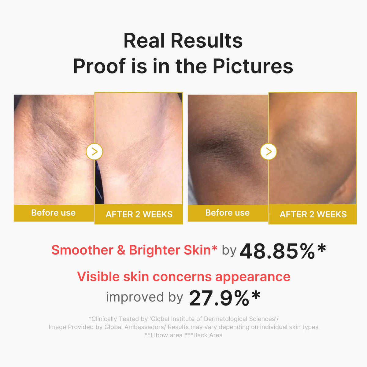 kojic-acid-turmeric-body-peel-shot-u6 02_72880cfc-382b-440b-8152-7e3dce87da2a.jpg