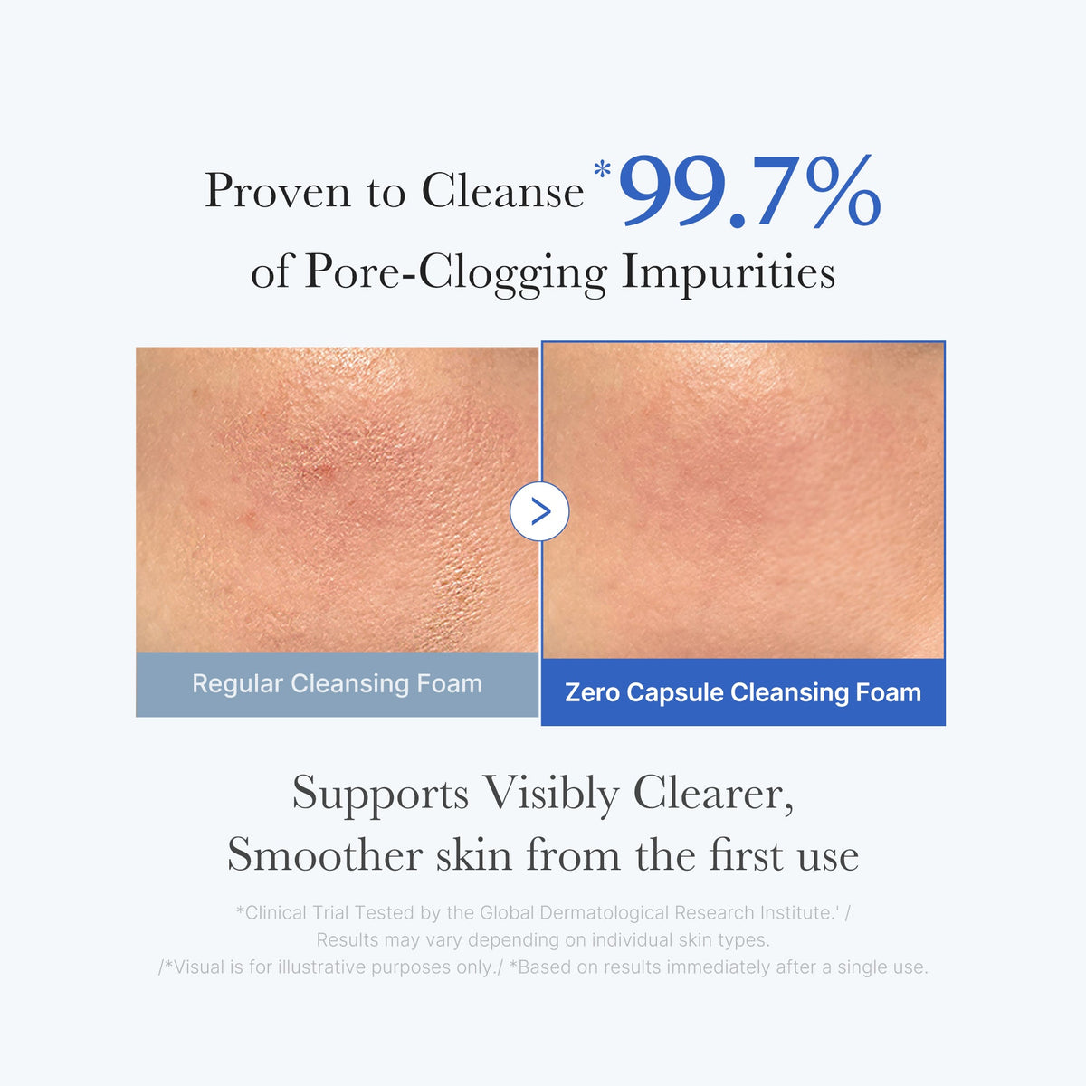 zero-pore-capsule-cleansing-foam-c5 02_c1fb9dfb-86c5-4038-8ff8-490d1006276c.jpg