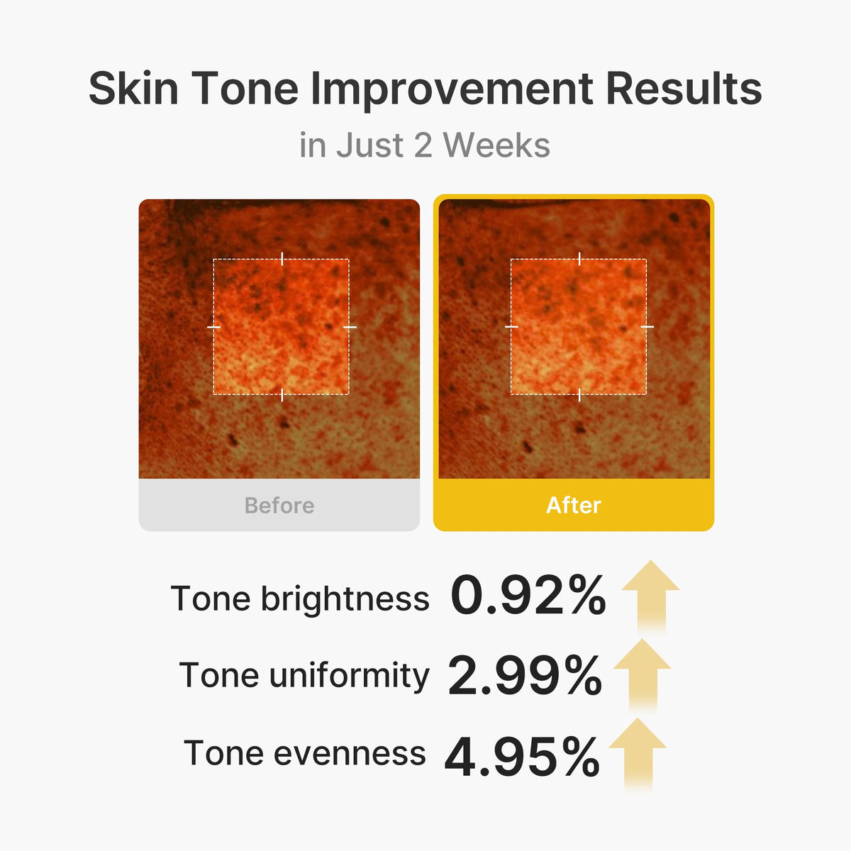 kojic-acid-turmeric-vita-capsule-cream-b3 03_2b626701-fc6c-4702-9e96-a2157a4f7f9d.jpg
