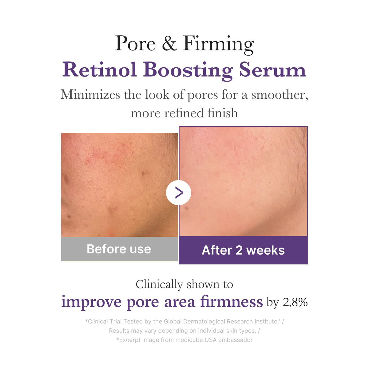retinol-nmn-boosting-serum-i1 03_3510e7a5-5633-4a18-81ea-1389593bd517.jpg