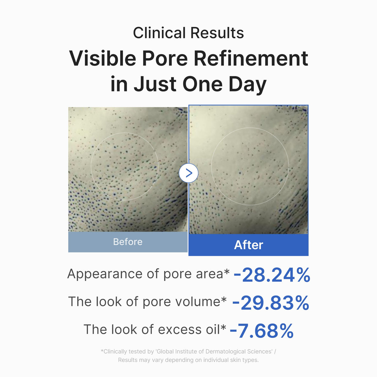 zero-pore-one-day-peptide-serum-c3 03_448eab9e-dc60-4dcb-9e4e-e863aabb61b0.jpg