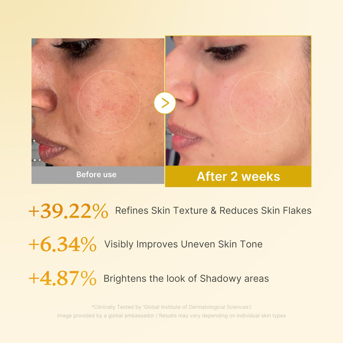 kojic-acid-turmeric-toner-w4 03_b7578d52-4c93-4407-9c6c-7cb230c85b06.jpg