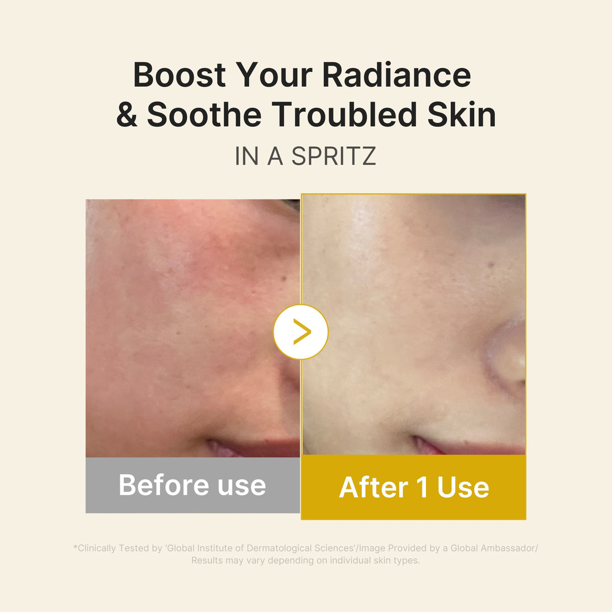 kojic-acid-turmeric-vitamin-gold-jelly-mist-serum-p8 03_dc9cd19e-4e57-49d3-9b66-c7762e8a63f1.jpg