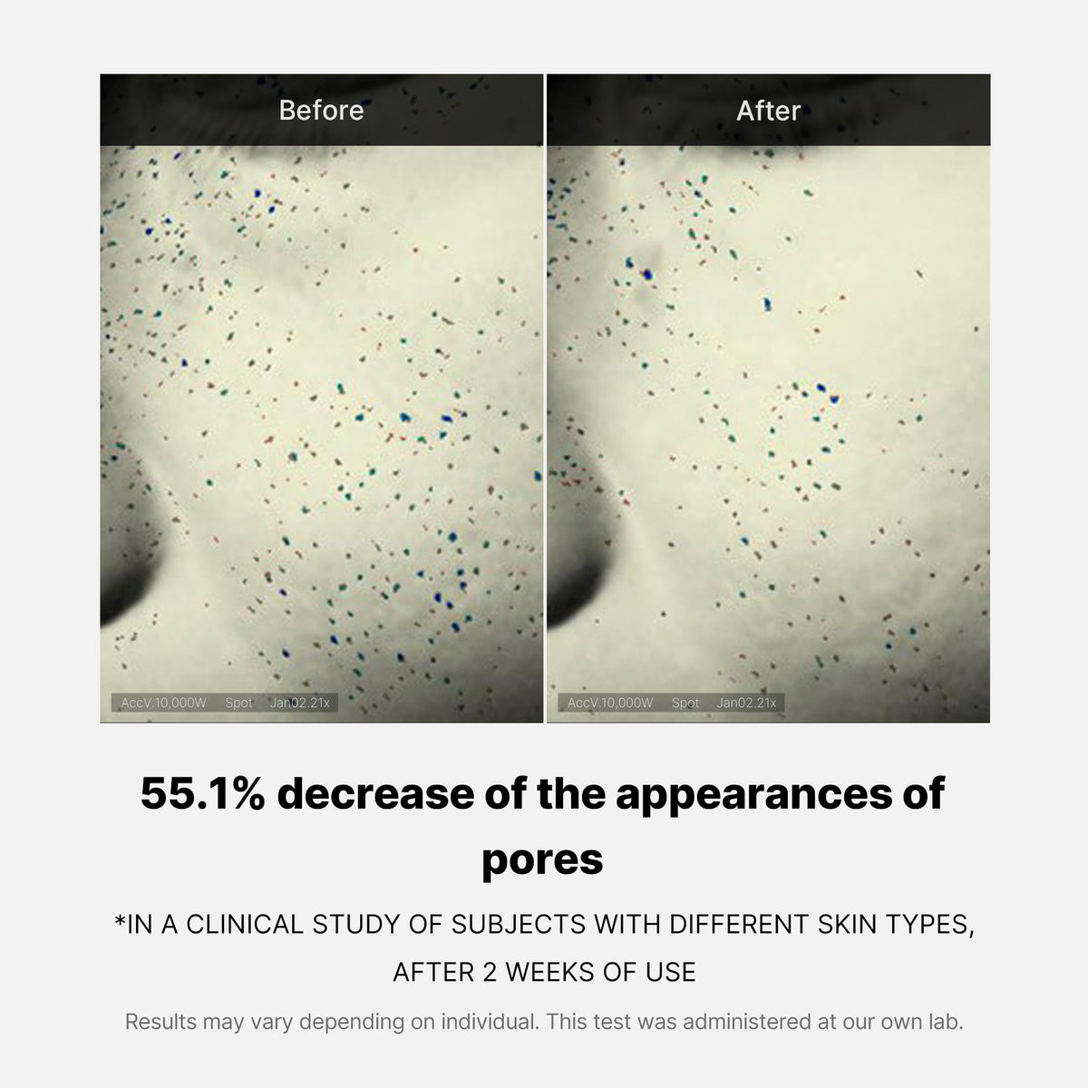 zero-pore-one-day-cream-u5 04_3616addc-f184-4deb-a5d7-e3a782e4713d.jpg