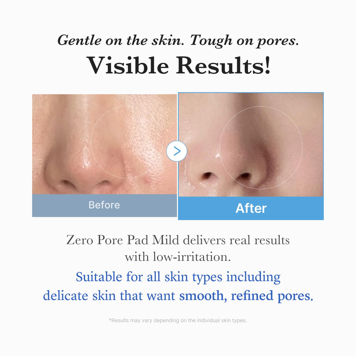 zero-pore-madecassoside-pads-mild-c3 04_6357f9f9-483b-4891-82c6-a58d336e62c8.jpg