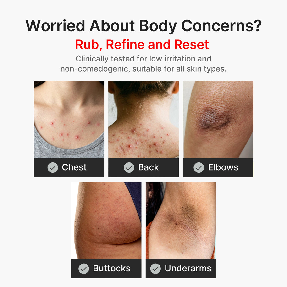 kojic-acid-turmeric-body-peel-shot-u6 04_8a7237f2-3ebf-401e-bd85-54841aeb3efc.jpg