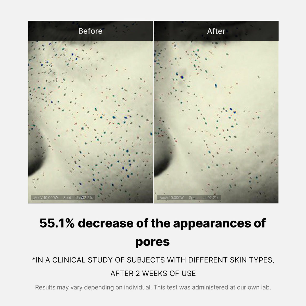 pore-care-duo-x8 05_12ddab8a-64be-4612-8ee1-27e5ec701921.jpg