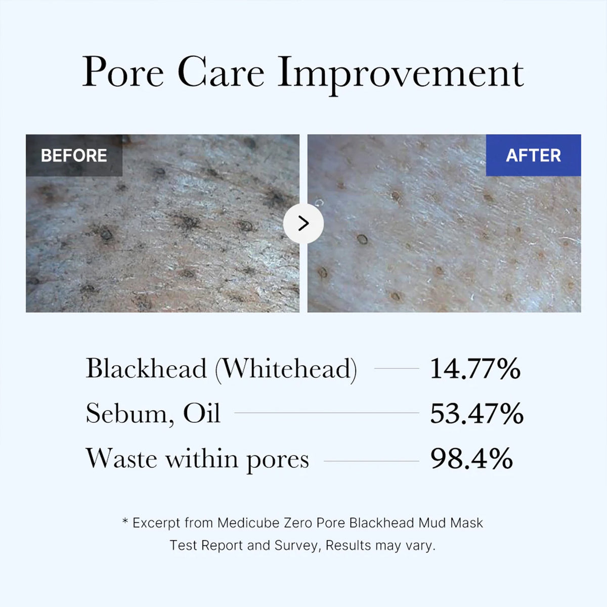 zero-pore-blackhead-mud-mask-i4 05_9362a158-c2b3-4525-acc0-631a2cfdea47.jpg