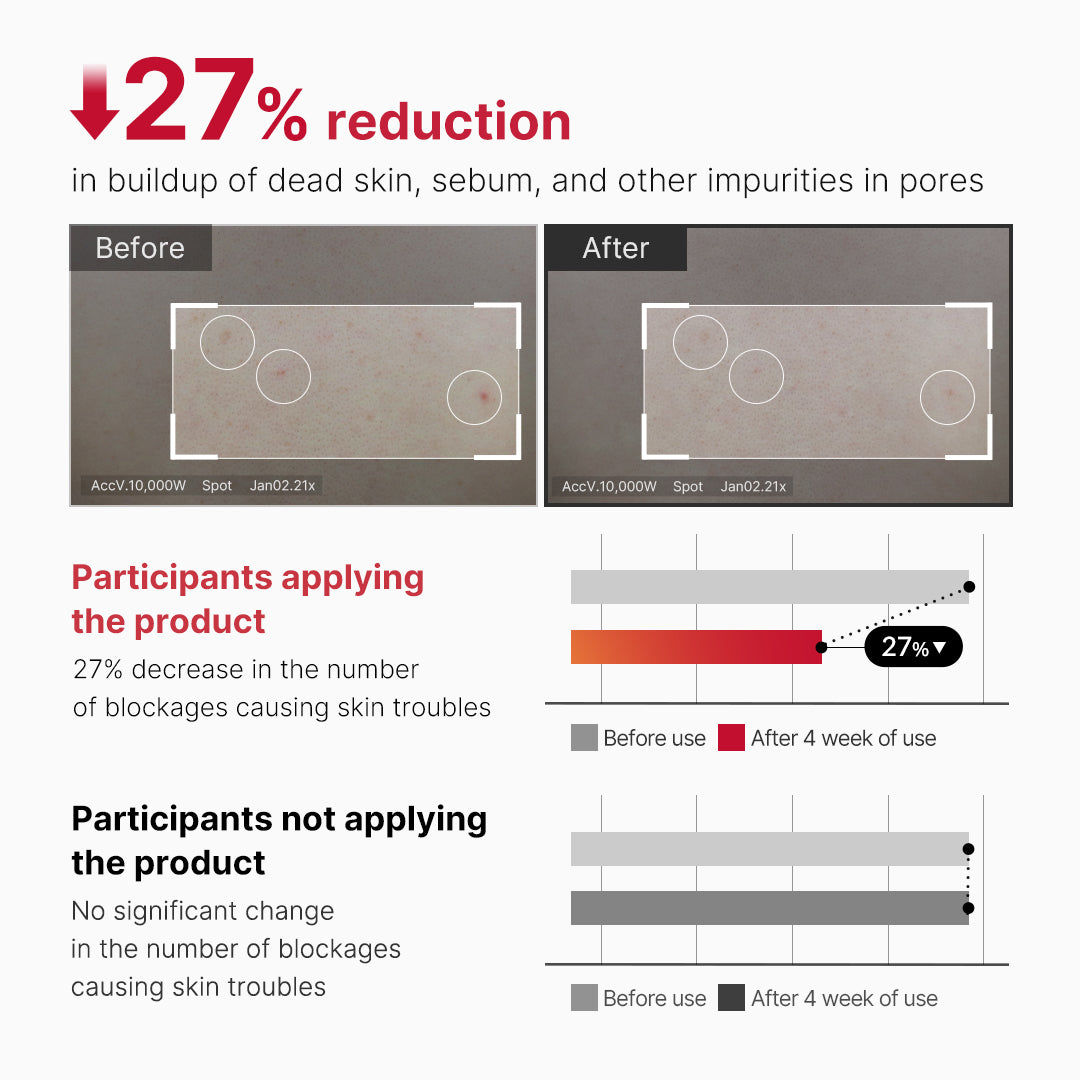 red-body-peeling-shot-cleanser-s8 07_60b5b2fd-b0f0-4cae-b358-5c38181e8dd8.jpg