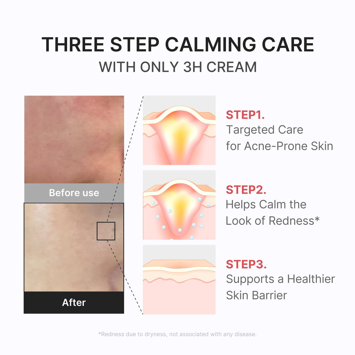 3h-daily-relief-cream-s7 3H_04.jpg