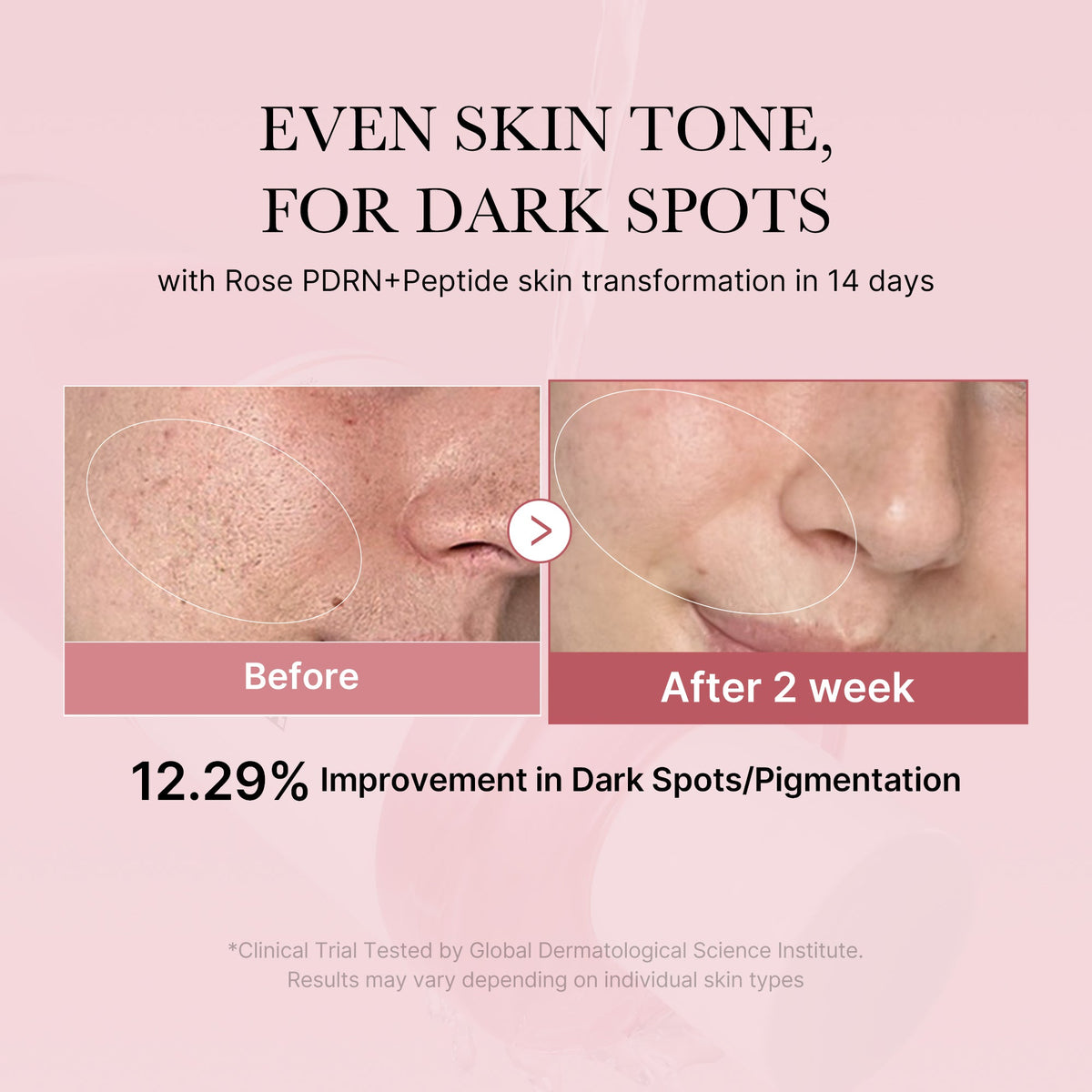 pdrn-pink-peptide-toner-a3 PDRN_01_308c518e-5ac6-4e54-99bd-eabc8796739b.jpg