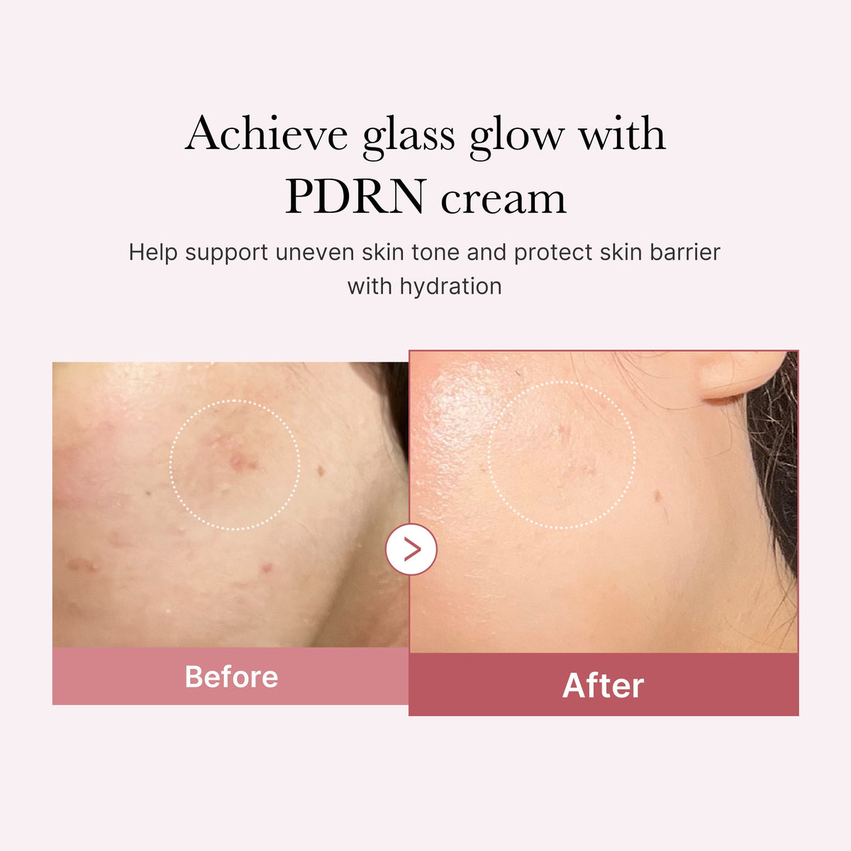 pdrn-pink-peptide-cream-e9 PDRN_02_d7805bfe-cf43-446a-b71b-a276683f136b.jpg