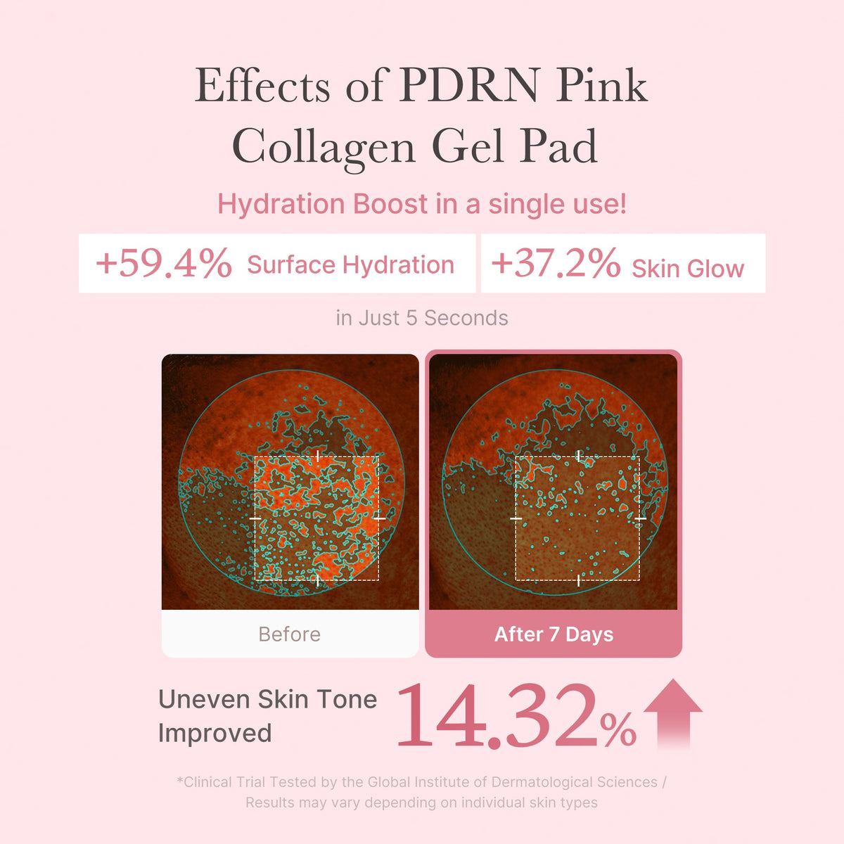 pdrn-pink-collagen-gel-toner-pad-u2 PDRN_04_f9a16a56-8d9e-4c47-a635-ed34ec3ed571.jpg