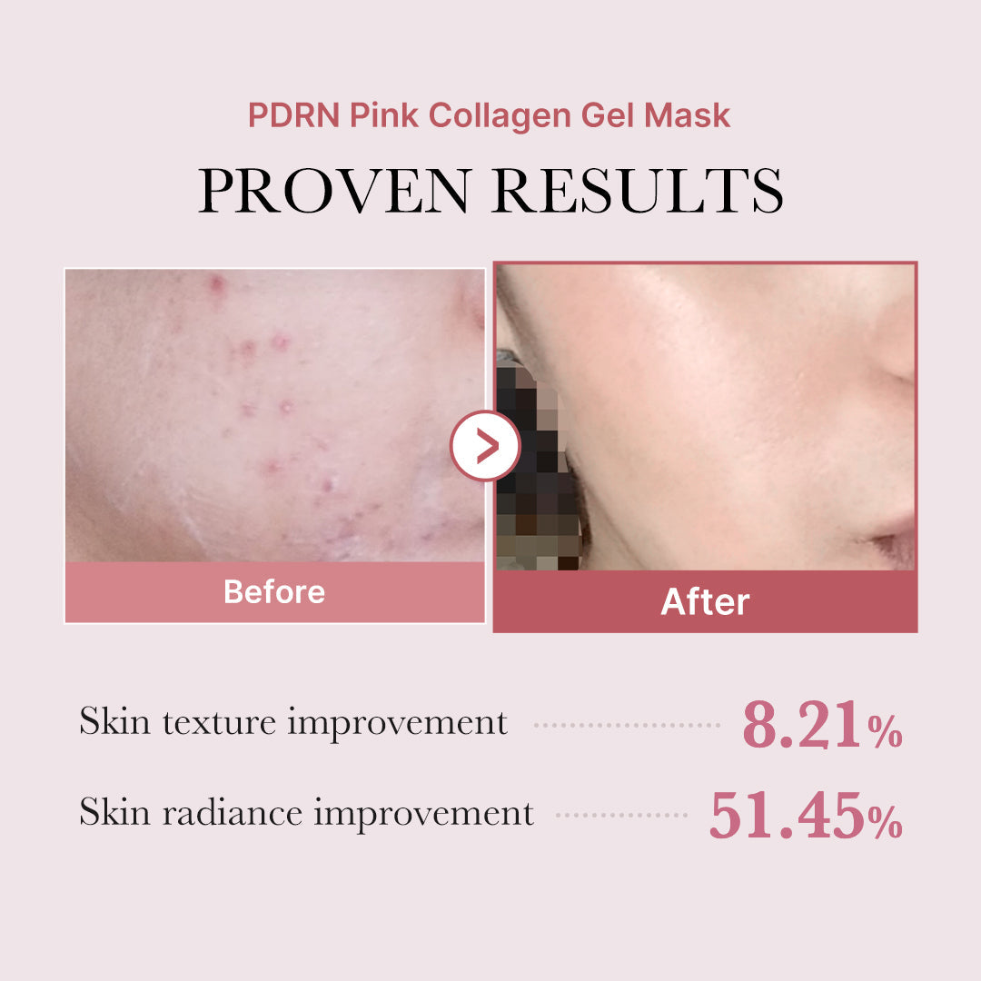 pdrn-pink-glow-full-set-k4 PDRN_12.jpg